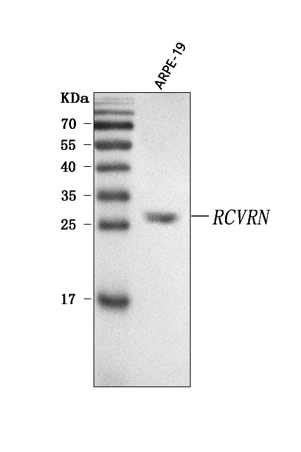  Western blot analysis of Recoverin/RCVRN using anti-Recoverin/RCVRN antibody (A06882-2)