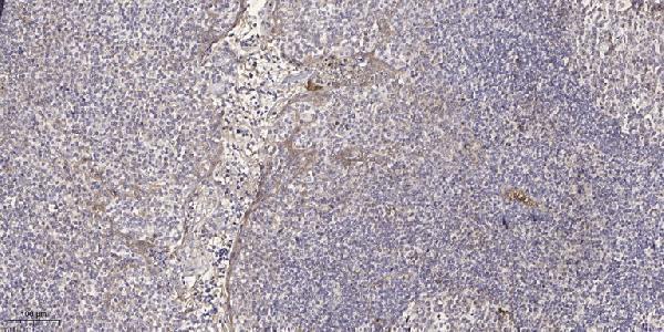 a06882 rcvrn primary antibodies ihc testing 1