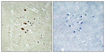 a06883 1 rraga primary antibodies ihc testing 1