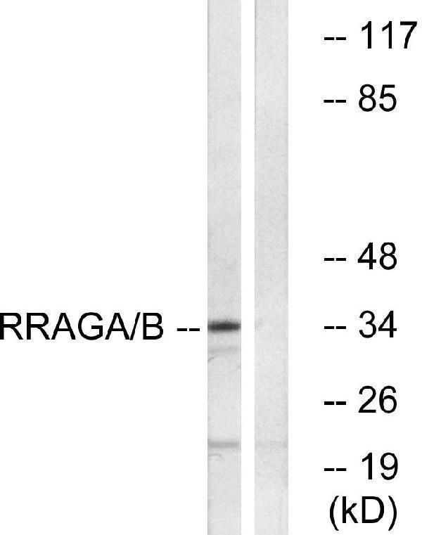 Western blot analysis of lysates from HepG2 cells, using RRAGA/B Antibody