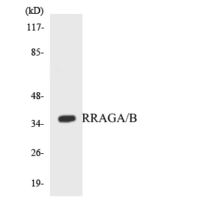 Western blot analysis of the lysates from HepG2 cells using RRAGA/B antibody