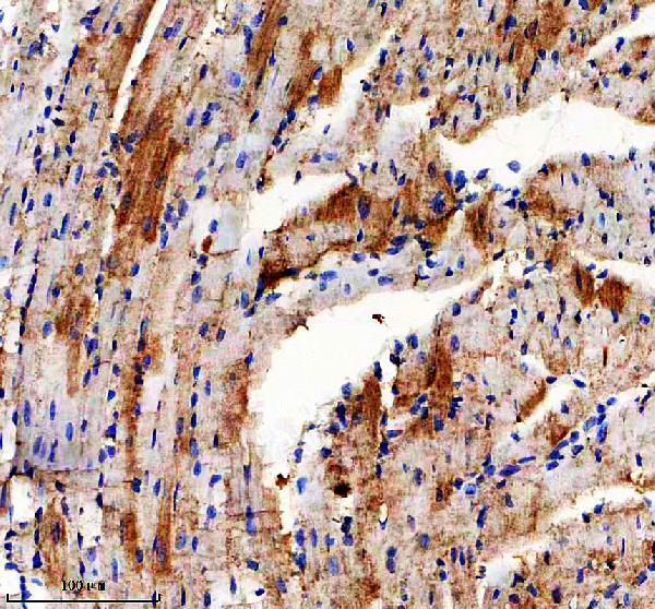 IHC analysis of KYNU using anti-KYNU antibody (A06885-1)