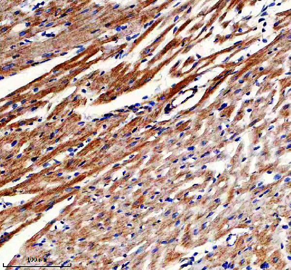 IHC analysis of KYNU using anti-KYNU antibody (A06885-1)