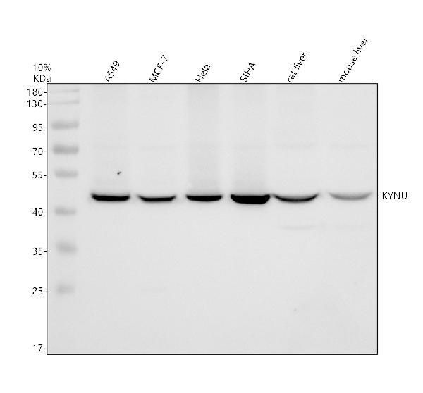 Western blot analysis of KYNU using anti-KYNU antibody (A06885-1)