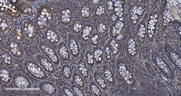 a06887 1 mief1 primary antibodies ihc testing 3