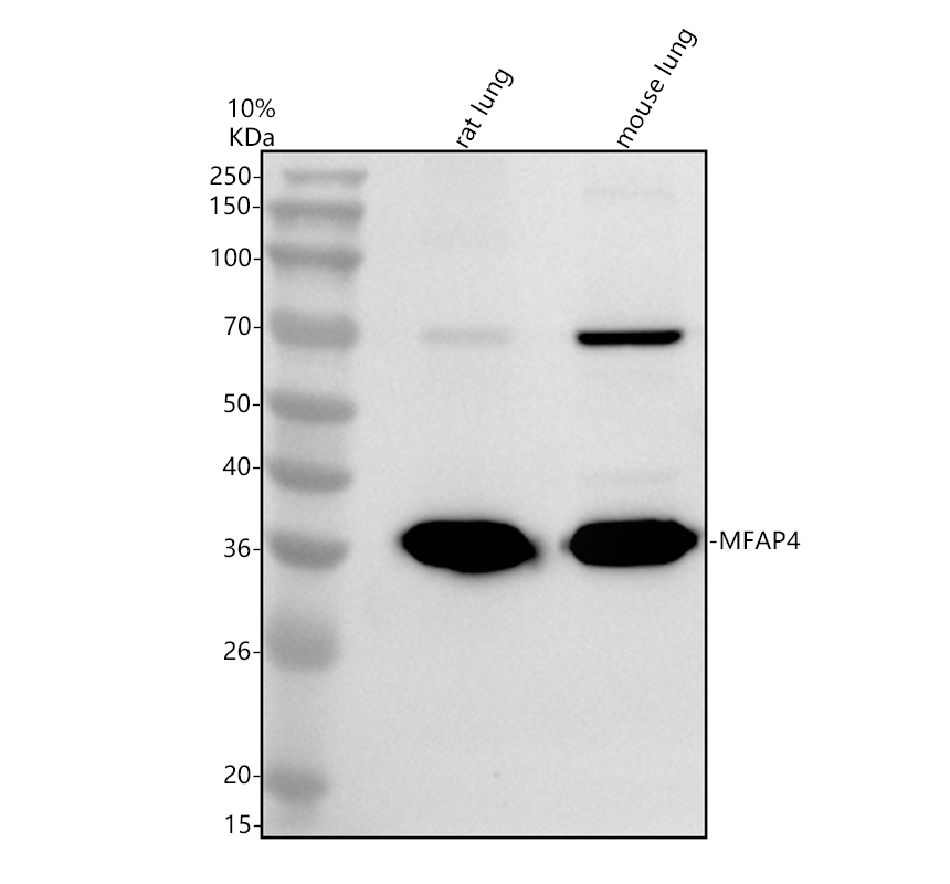 Western blot analysis of MFAP4 using anti-MFAP4 antibody (A06888-1)