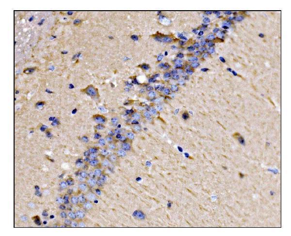 a06890 2 dnm3 primary antibodies ihc testing 2