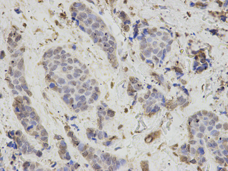 Immunofluorescence analysis of C6 cells using PSMB1 antibody  at dilution of 1:100