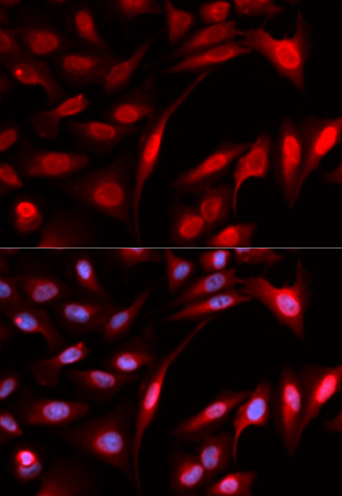Immunofluorescence analysis of L929 cells using PSMB1 antibody  at dilution of 1:100