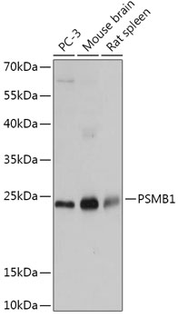 Western blot analysis of extracts of various cell lines, using PSMB1 antibody  at 1:1000 dilution