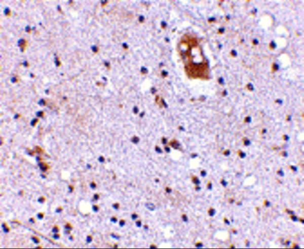 a06892 1 tmc8 primary antibodies ihc testing 2