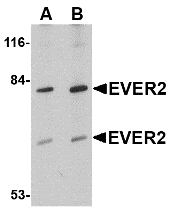 a06892 1 tmc8 primary antibodies wb testing 1