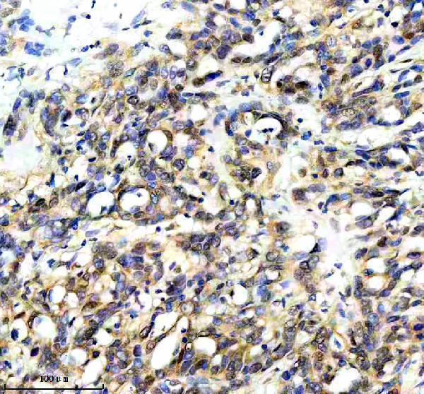 IHC analysis of GTF2B using anti-GTF2B antibody (A06893)