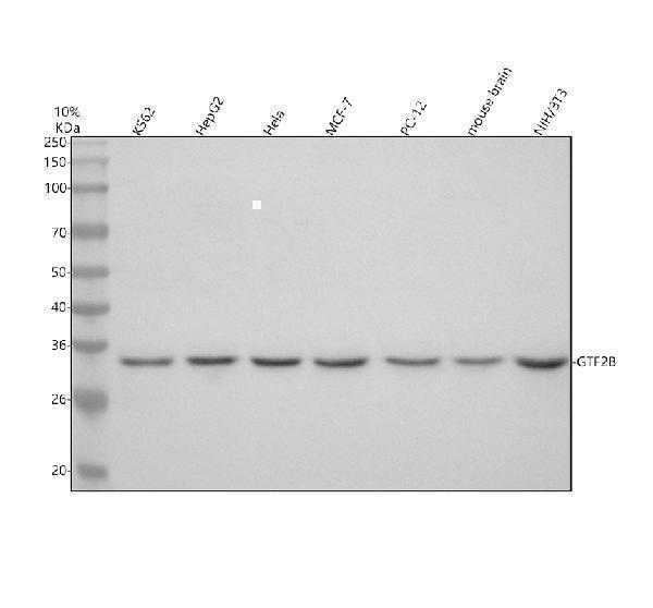 Western blot analysis of GTF2B using anti-GTF2B antibody (A06893)