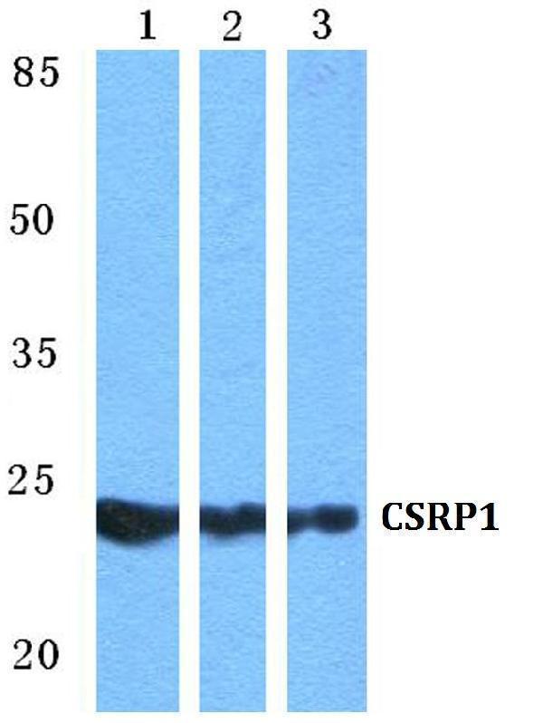 Western blot (WB) analysis of CSRP1 polyclonal antibody at 1:500 dilution
Lane1:HEK293T cell lysate
Lane2:Mouse heart tissue lysate
Lane3:Rat heart tissue lysate