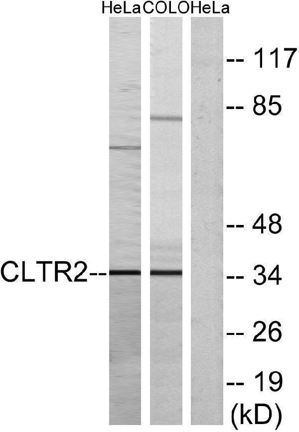 a06895 cysltr2 primary antibodies wb testing 1