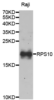 a06898 rps10 primary antiboties wb testing 1
