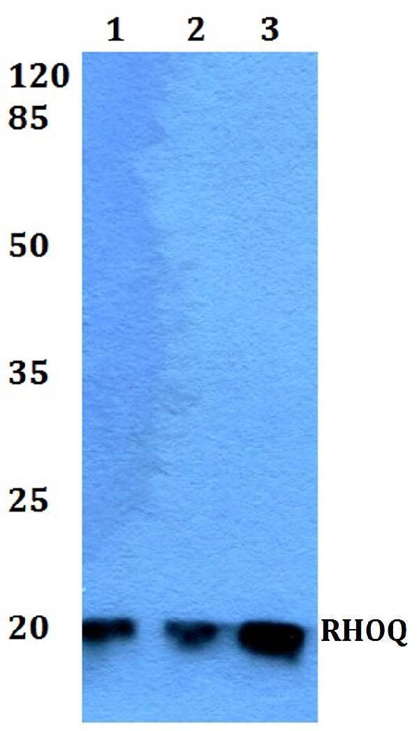 Western blot (WB) analysis of RHOQ polyclonal antibody at 1:500 dilution
Lane1:HEK293T whole cell lysate
Lane2:Raw264