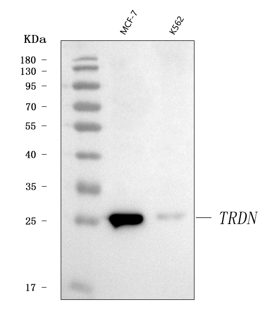  Western blot analysis of Triadin/TRDN using anti-Triadin/TRDN antibody (A06901)