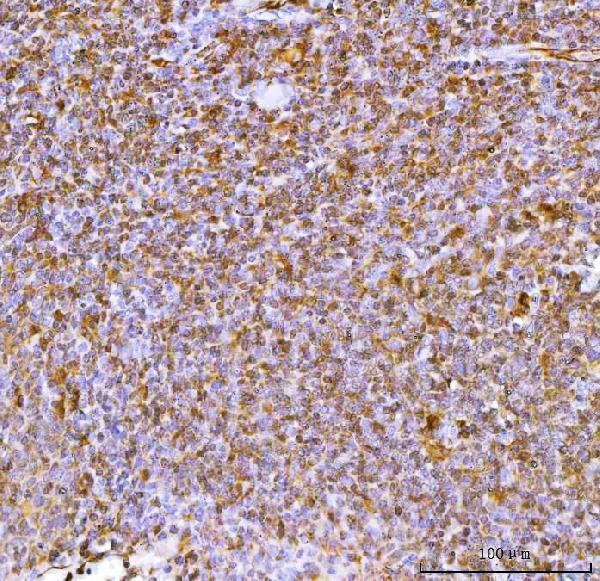  IHC analysis of IL34 using anti-IL34 antibody (A06903-3)