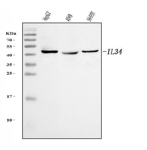  Western blot analysis of IL34 using anti-IL34 antibody (A06903-3)