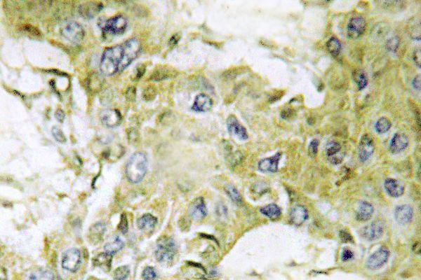 Immunohistochemistry (IHC) analyzes of Casein Kinase Iγ1 (H3) pAb in paraffin-embedded human brain tissue