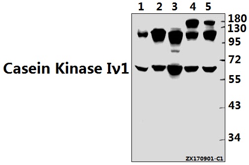 Western blot (WB) analysis of Casein Kinase Iγ1 (H3) pAb at 1:500 dilution
Lane1:3T3-L1 whole cell lysate(40ug)
Lane2:C6 whole cell lysate(40ug)
Lane3:HEK293T whole cell lysate(40ug)
Lane4:MCF-7 whole cell lysate(40ug)
Lane5:A549 whole cell lysate(40ug)