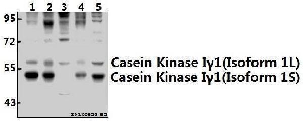Western blot (WB) analysis of Casein Kinase Iγ1 (H3) pAb at 1:500 dilution
Lane1:MCF-7 whole cell lysate(40ug)
Lane2:A549 whole cell lysate(40ug)
Lane3:Hela whole cell lysate(40ug)
Lane4:EC9706 whole cell lysate(40ug)
Lane5:A2780 whole cell lysate(40ug)