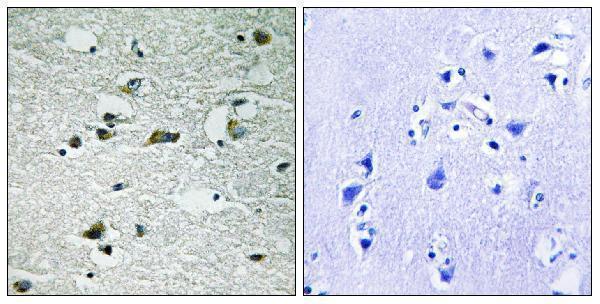 Immunohistochemistry analysis of paraffin-embedded human brain, using CK-1 gamma1/2/3 (Phospho-Tyr263) Antibody