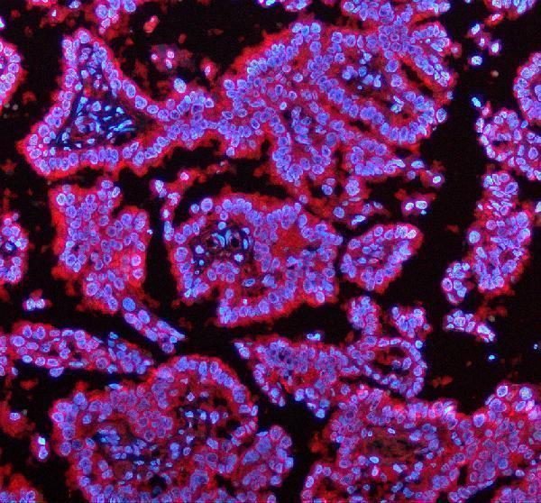 a06908 2 entpd5 primary antibodies if testing 1