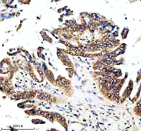 IHC analysis of ENTPD5 using anti-ENTPD5 antibody (A06908-2)