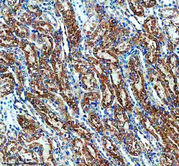 IHC analysis of ENTPD5 using anti-ENTPD5 antibody (A06908-2)