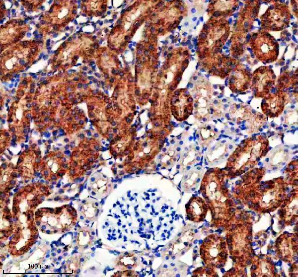 a06908 2 entpd5 primary antibodies ihc testing 3
