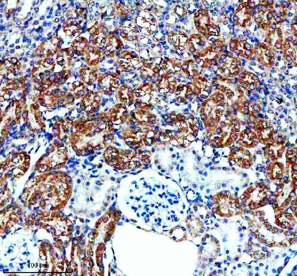a06908 2 entpd5 primary antibodies ihc testing 5