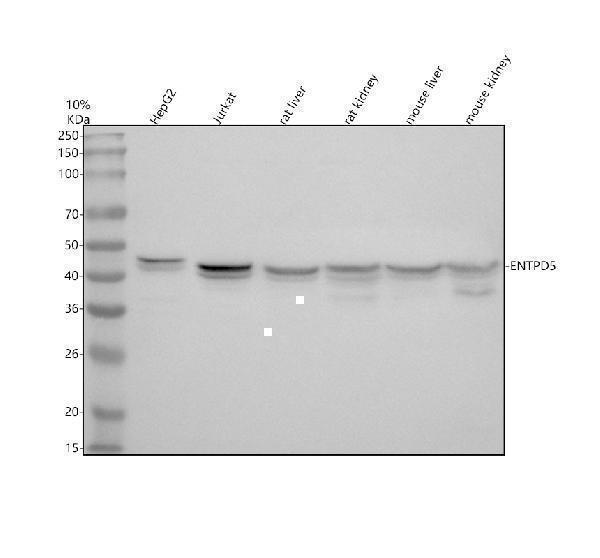 Western blot analysis of ENTPD5 using anti-ENTPD5 antibody (A06908-2)