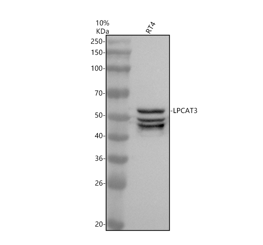 a06910 1 lpcat3 primary antibodies wb testing 1_1