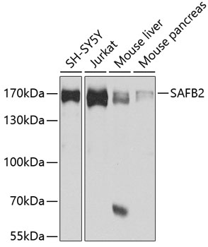 a06911 safb2 primary antiboties wb testing 1