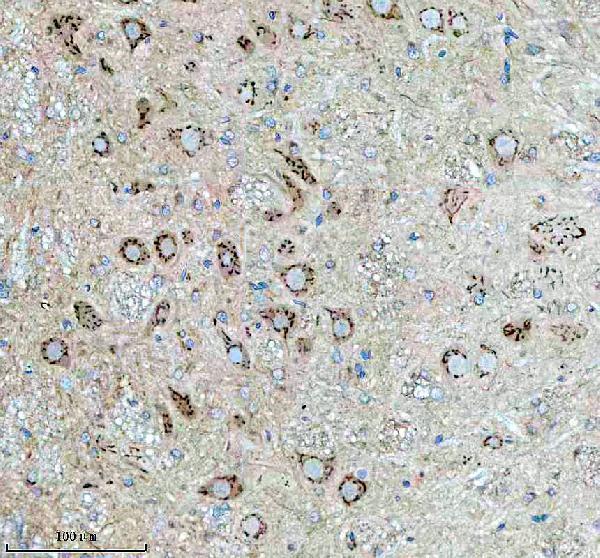 a06912 1 mtco3 primary antibodies ihc testing 11