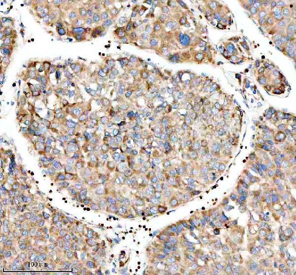  IHC analysis of MTCO3 using anti-MTCO3 antibody (A06912-1)
