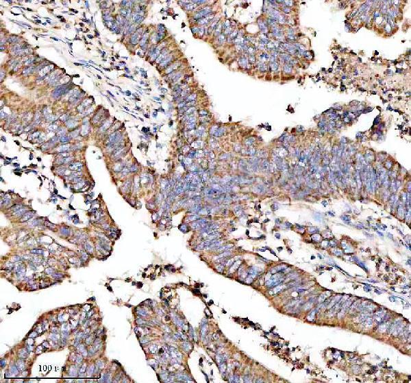  IHC analysis of MTCO3 using anti-MTCO3 antibody (A06912-1)