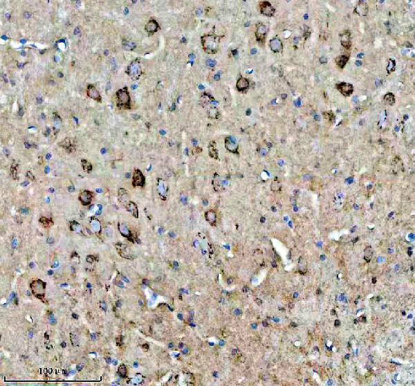 a06912 1 mtco3 primary antibodies ihc testing 9