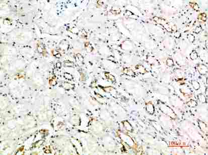 a06913 art4 primary antibodyes ihc testing 1