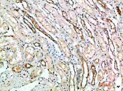a06913 art4 primary antibodyes ihc testing 2