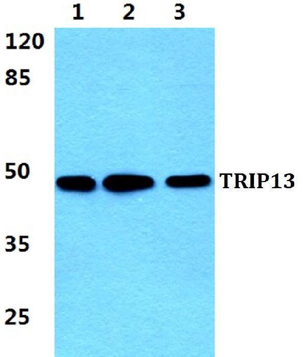 Western blot (WB) analysis of TRIP13 polyclonal antibody at 1:500 dilution
Lane1:Hela cell lysate
Lane2:NIH-3T3 cell lysate
Lane3:PC12 cell lysate