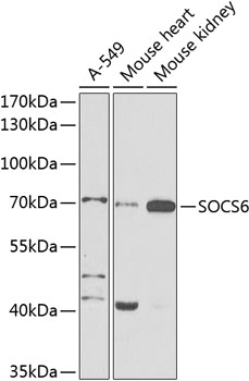 a06923 socs6 primary antiboties wb testing 1