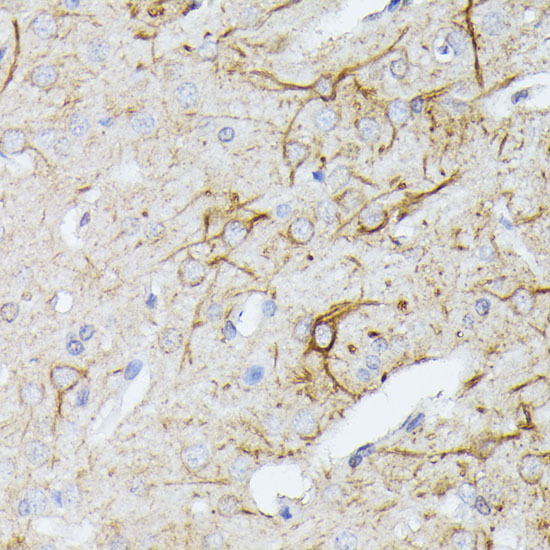 a06926 tbca primary antiboties ihc testing 2