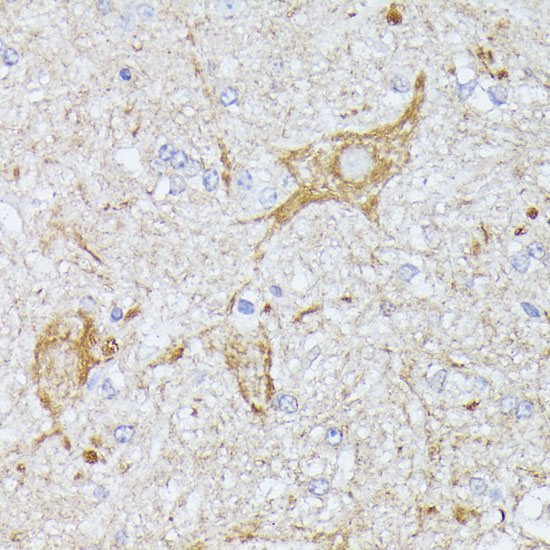 a06926 tbca primary antiboties ihc testing 3