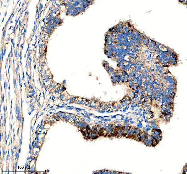 a06933 1 fdxr primary antibodies ihc testing 1