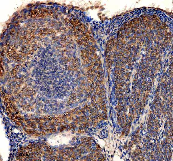a06933 1 fdxr primary antibodies ihc testing 3