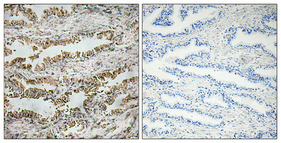 Immunohistochemical analysis of paraffin-embedded Human prostate cancer